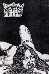 Dismembered Fetus : Broken Neck